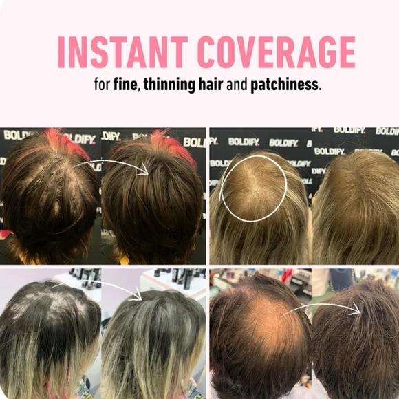 Hair Thickening Fibers - Dark Brown - Picture 3 of 3